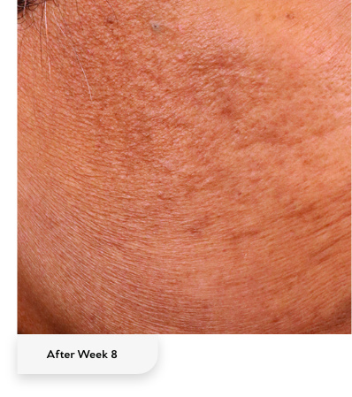 After week 8